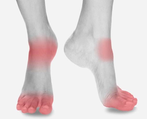 types-of-arthritis-that-affect-feet-osteoarthritis-rheumatoid-foot-heath-shoes-3-min1